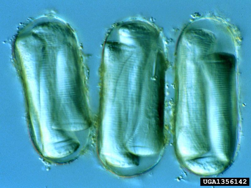 Yellow potato cyst nematode (Globodera rostochiensis) eggs {!--감자씨스트선충 알-->; DISPLAY FULL IMAGE.