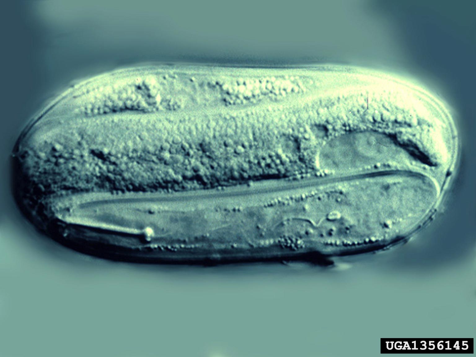 Yellow potato cyst nematode (Globodera rostochiensis) eggs {!--감자씨스트선충 알-->; Image ONLY
