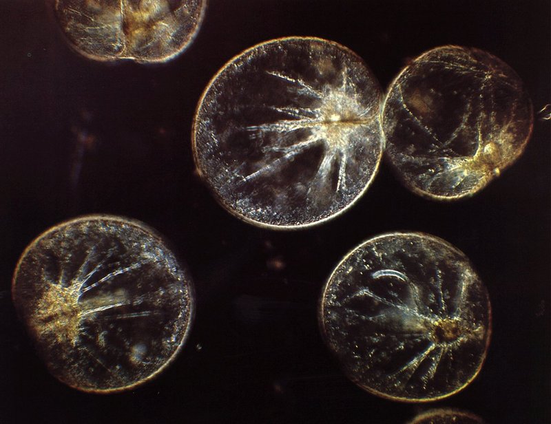 [Marine Microorganism] heterotrophic dinoflagellates (Noctiluca miliaris); DISPLAY FULL IMAGE.