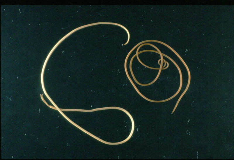 Gordian Worm (Paragordius tricuspidatus); DISPLAY FULL IMAGE.