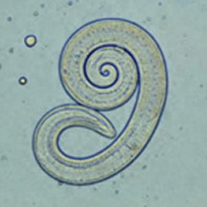 Trichinella spiralis; Image ONLY