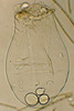 photo of rotifer Asplanchna priodonta