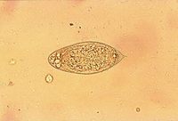 Schistosoma haematobium