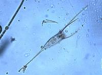 Kellicottia longispina