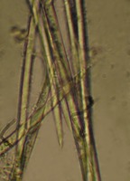 Spongilla lacustris