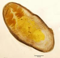 Clinostomum complanatum