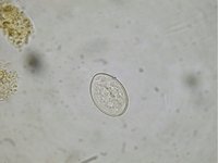 Diphyllobothrium latum