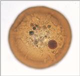 Protozoa - Amoebae - Arcella once more