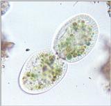 Protozoa sensation: ciliate with visible cilia