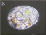Protozoa series - new scans, #6 - a ciliate, darkfield and an off-topic bonus shot