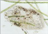 Protozoa - more ciliates - Euplotes
