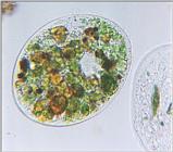Protozoa series - new scans, #9 - a huge fat ciliate
