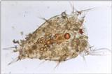 Protozoa - nauplius