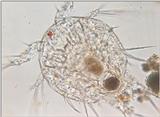 Protozoa series - new scans, #3 - another Nauplius (the last one, I promise)