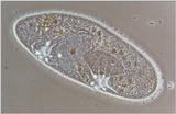Protozoa - Paramecium caudatum take three - REPOST