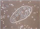 Protozoa - new scans, #1 - can you stand one more Paramecium caudatum?