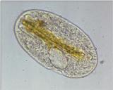 Protozoa - new scans, #2 - a hungry ciliate and its meal