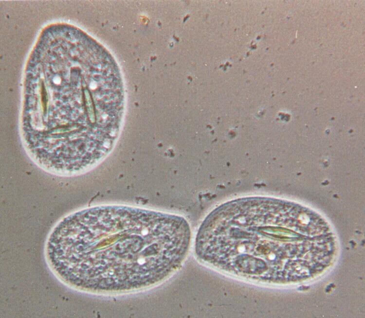 Protozoa series - REPOST #4 - The Ciliate Family - new scans coming soon; Image ONLY