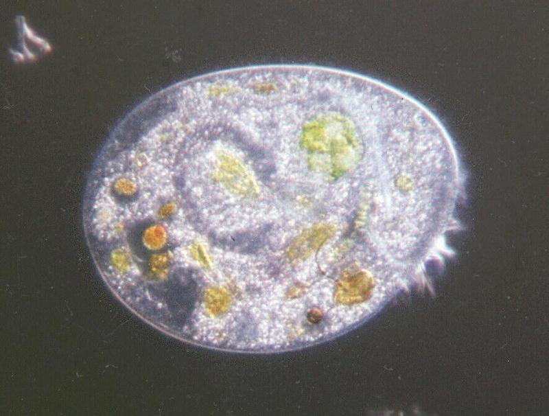 Protozoa series - new scans, #6 - a ciliate, darkfield and an off-topic bonus shot; DISPLAY FULL IMAGE.