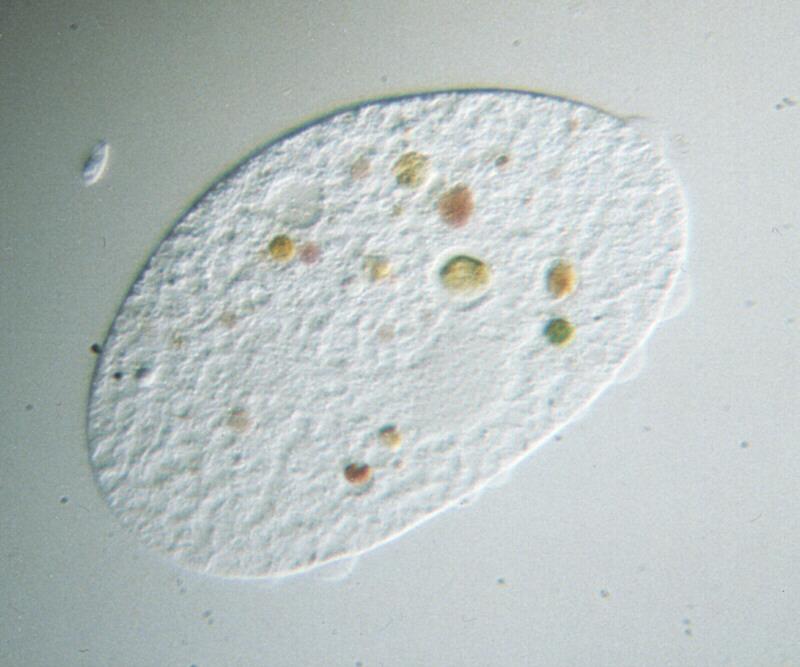 PING MacTrix - Protozoa - new scans, #5 - ciliate in excentric illumination; Image ONLY