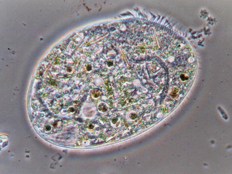 climacostomum virens (protozoon); DISPLAY FULL IMAGE.