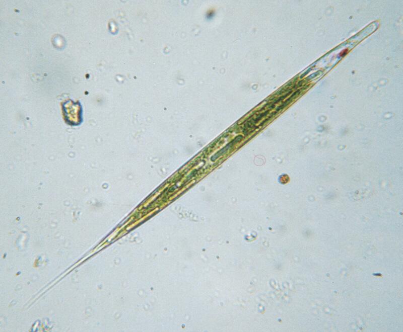 Protozoon: euglena acus; DISPLAY FULL IMAGE.