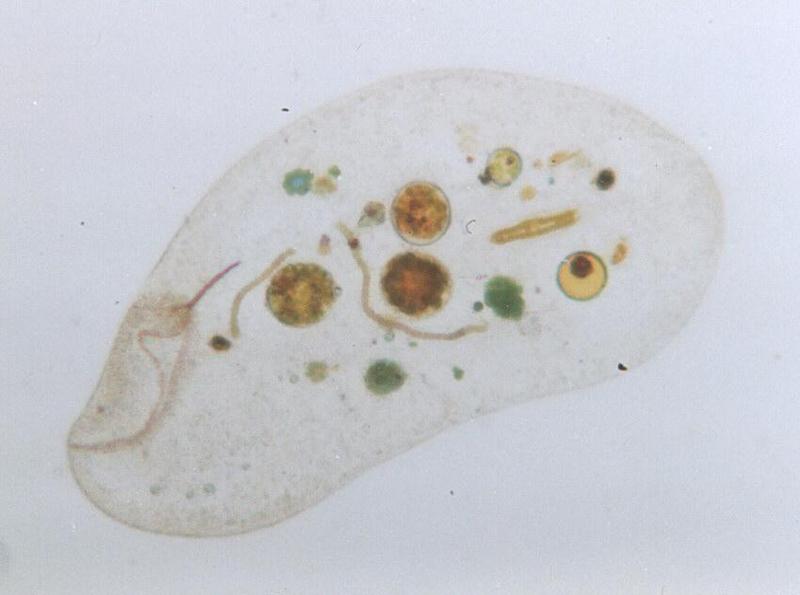 Protozoa - more ciliates - Loxodes; DISPLAY FULL IMAGE.