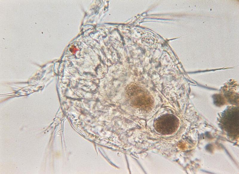 Protozoa series - new scans, #3 - another Nauplius (the last one, I promise); DISPLAY FULL IMAGE.