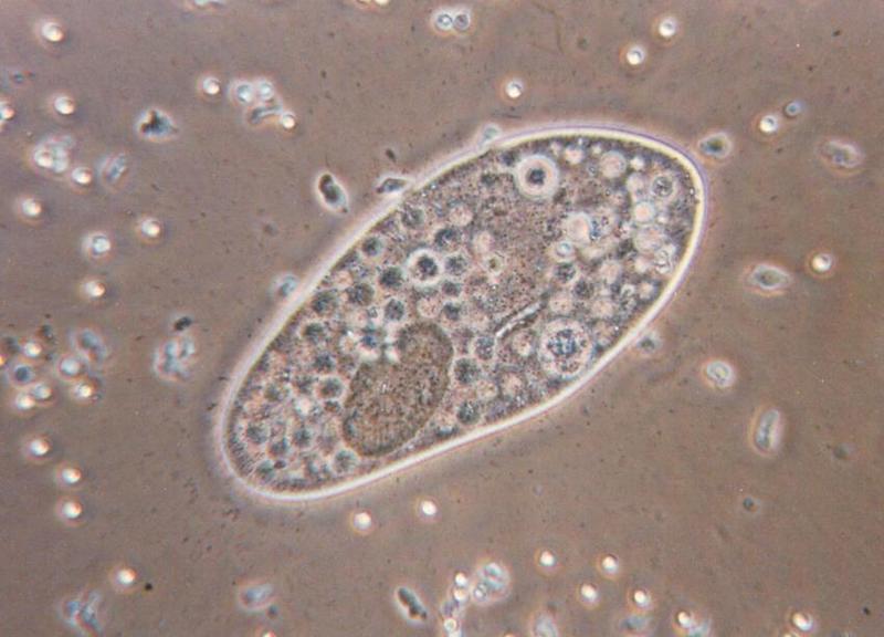 Protozoa - new scans, #1 - can you stand one more Paramecium caudatum?; DISPLAY FULL IMAGE.