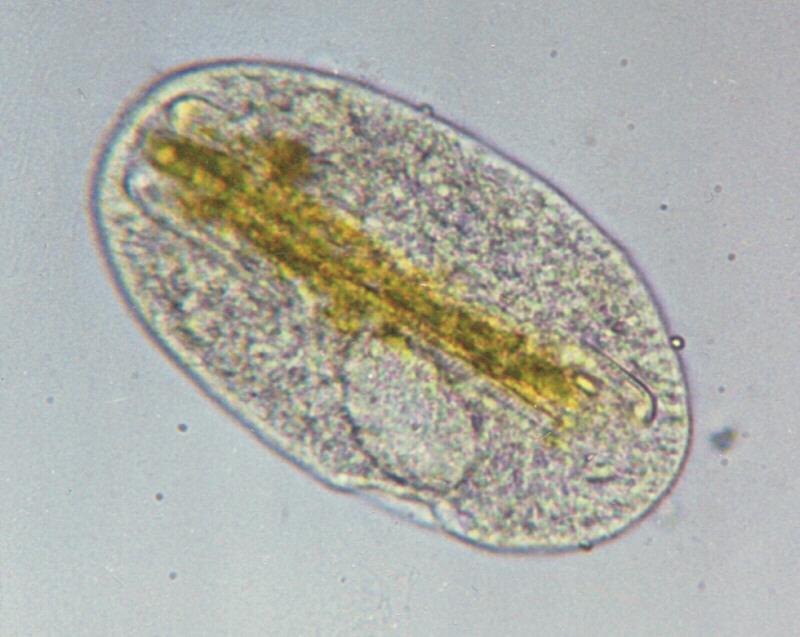 Protozoa - new scans, #2 - a hungry ciliate and its meal; DISPLAY FULL IMAGE.