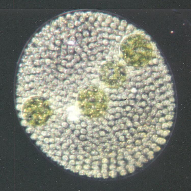 Protozoa series - new scans, #6 - a ciliate, darkfield and an off-topic bonus shot; Image ONLY